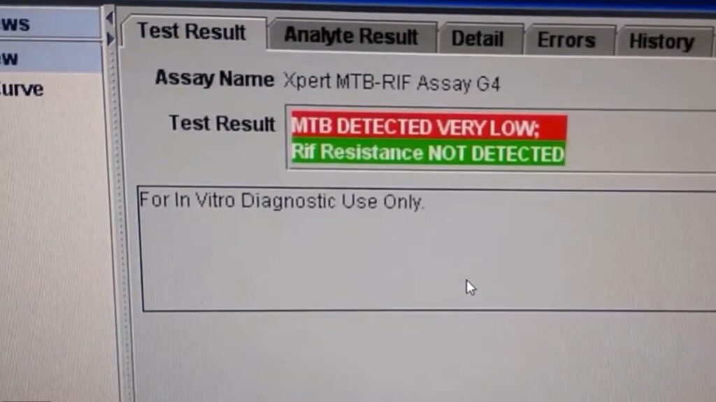 GeneXpert® Xpert® MTBRIF Test Result- MTB Detected (Very Low) and Rifampicin Resistance Not Detected