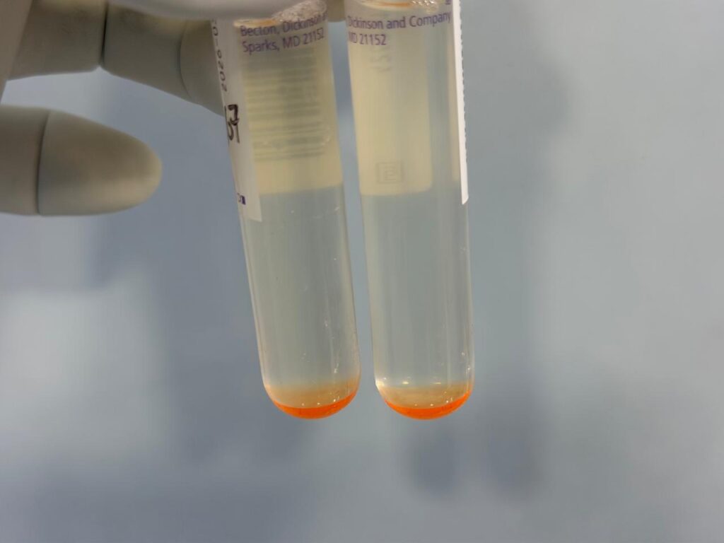 Mycobacteria Growth Indicator Tube (MGIT)-Contamination