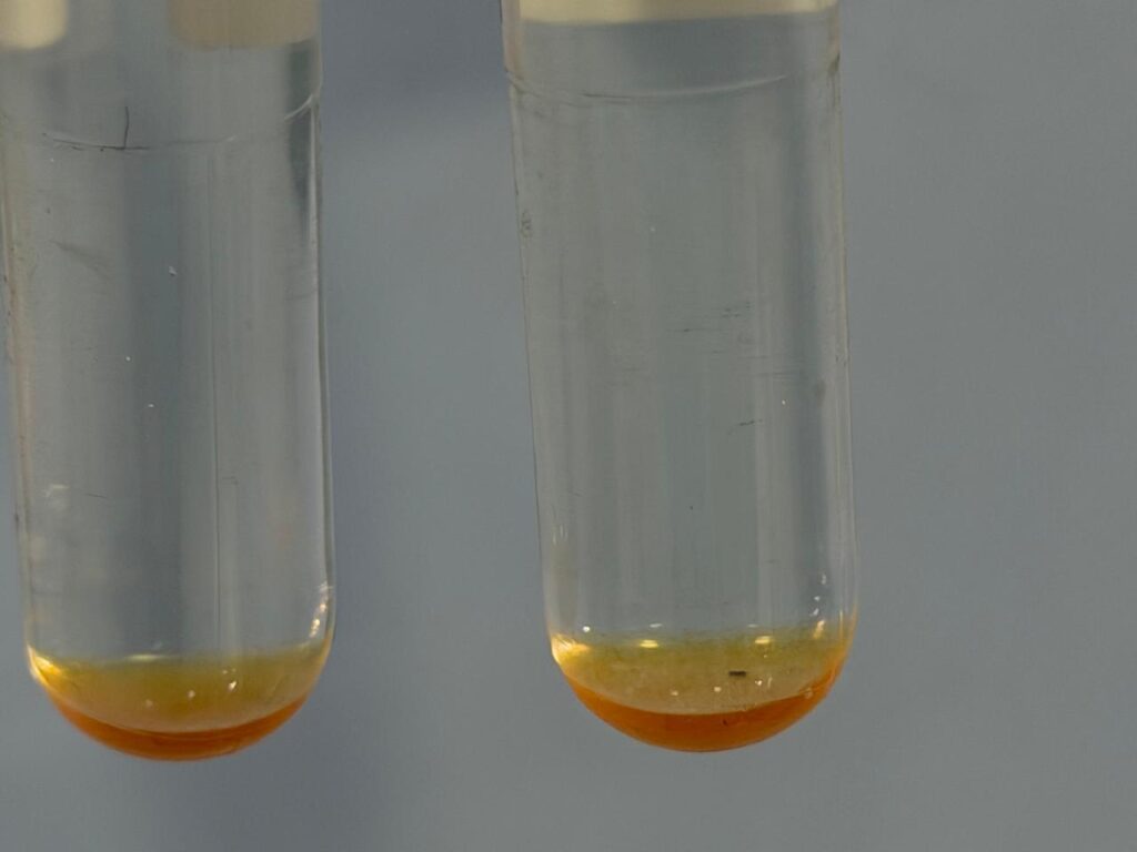 Mycobacteria Growth Indicator Tube (MGIT)-Positive