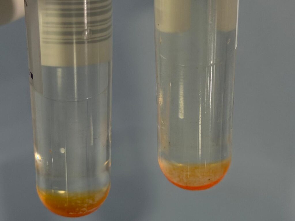 Mycobacteria Growth Indicator Tube (MGIT)-Positive