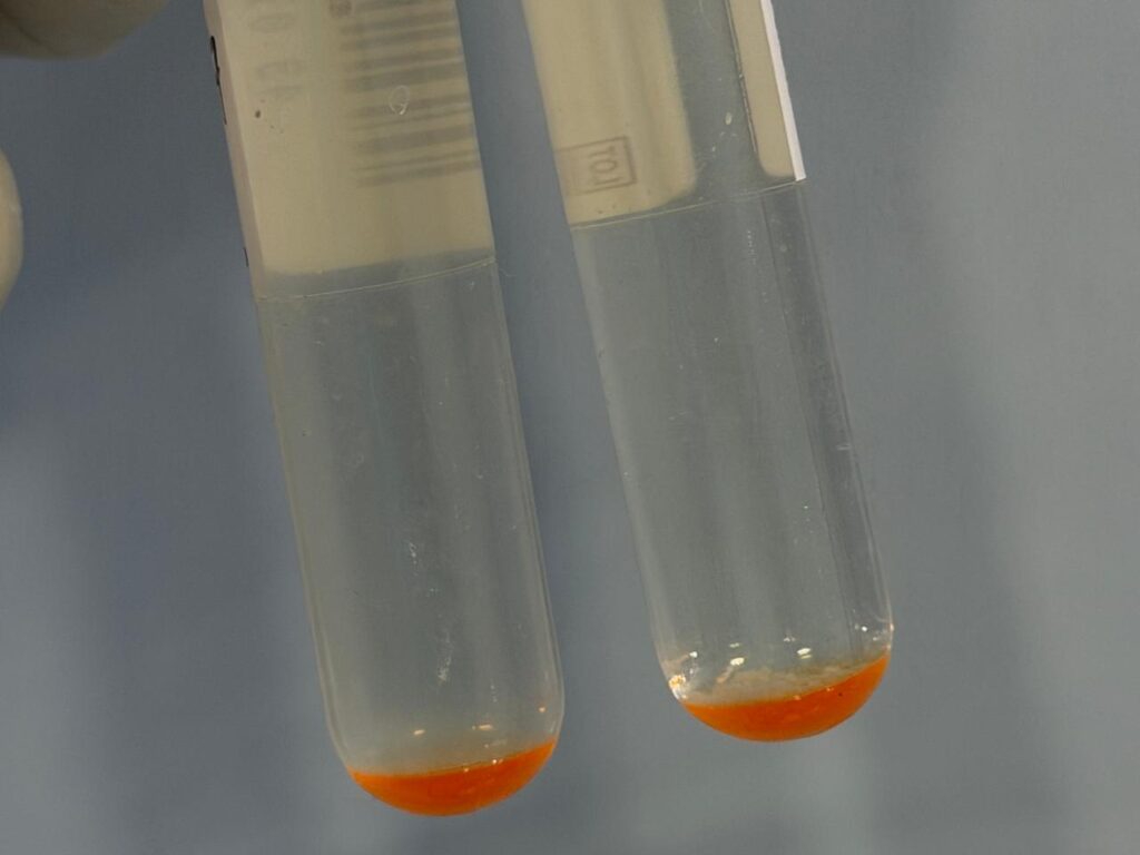 Negative MGIT tube (left) with clear medium versus a positive MGIT tube (right) showing characteristic granular mycobacterial clumping at the bottom