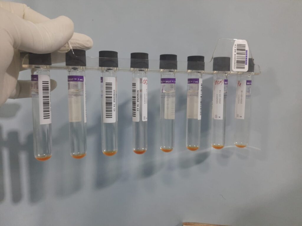 Phenotypic drug susceptibility testing (DST) of Mycobacterium tuberculosis using the BACTEC MGIT 960 system
