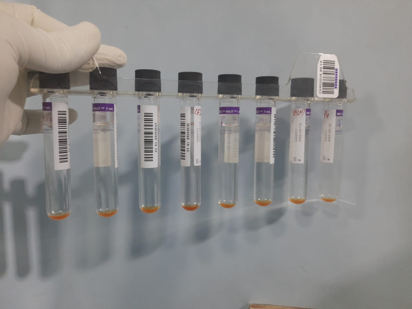 Phenotypic drug susceptibility testing (DST) of Mycobacterium tuberculosis using the BACTEC MGIT 960 system
