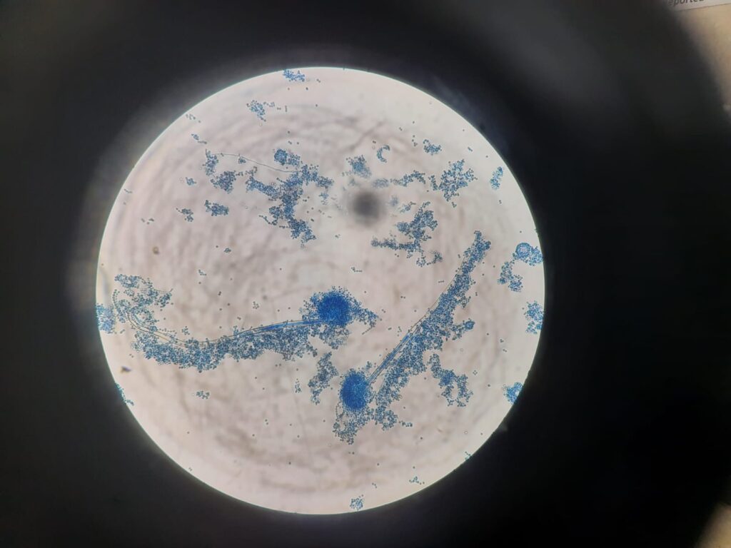 Photomicrograph of Aspergillus terreus in a Lactophenol Cotton Blue (LPCB) tease mount showing the characteristic biseriate conidial heads with compact, columnar chains of globose conidia supported by smooth-walled conidiophore