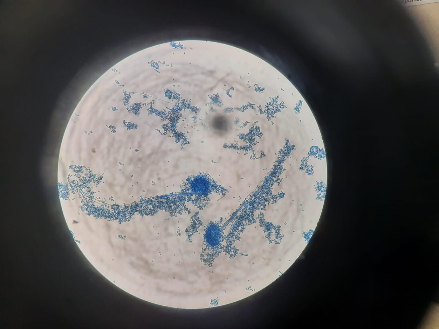 Aspergillus terreus