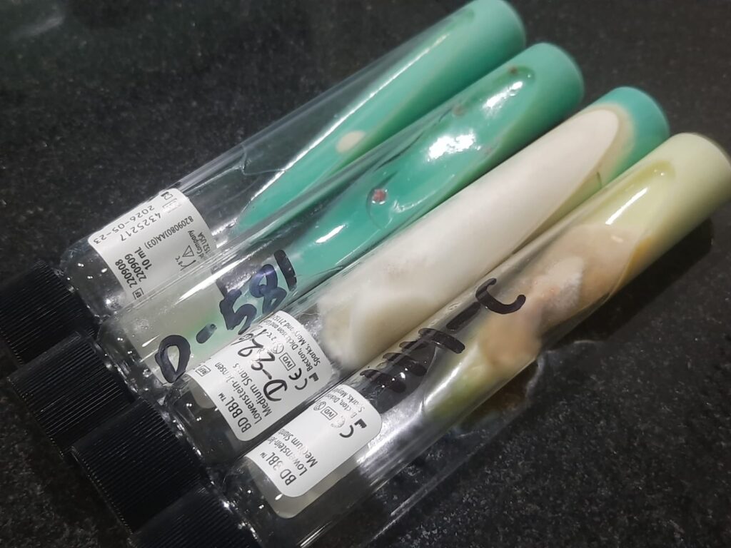 Spectrum of Contamination Patterns on L-J Media Slants: Fungal Overgrowth-The foreground slants exhibit dense, fuzzy, or "cotton-like" mycelial growth, characteristic of environmental molds such as Aspergillus or Penicillium. Media Alteration-Distinct loss of the malachite green indicator is visible in the heavily contaminated tubes, where the medium has turned a yellowish-white due to metabolic changes or pH shifts. Focal Contamination-The background slants show early "breakthrough" growth with isolated colonies appearing on the green surface before total overgrowth occurs.
