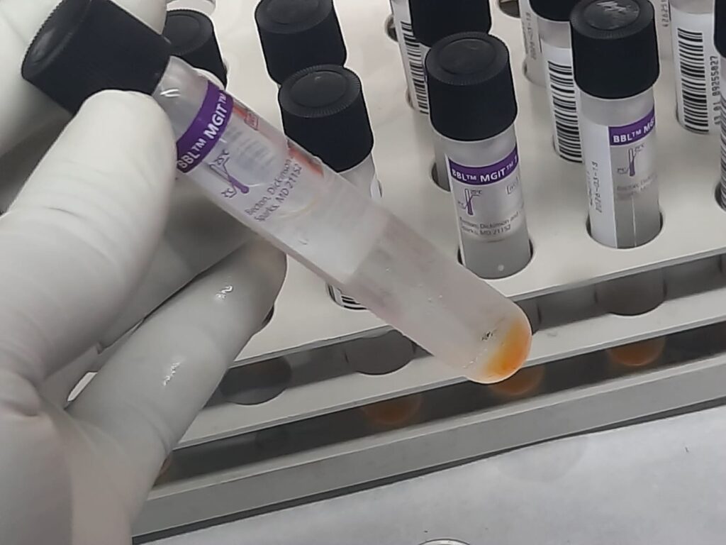 The BBL MGIT tube, showing Modified Middlebrook 7H9 Broth paired with an oxygen-sensitive fluorescent sensor for rapid diagnostic results