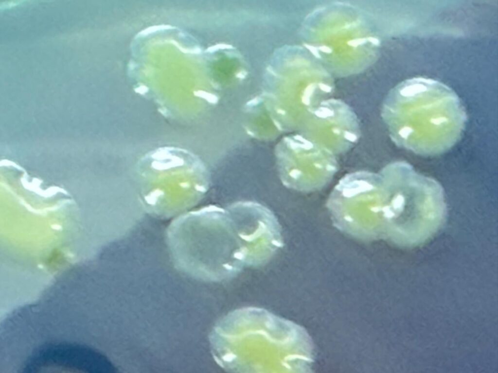 Acinetobacter baumannii complex colony morphology on CLED agar