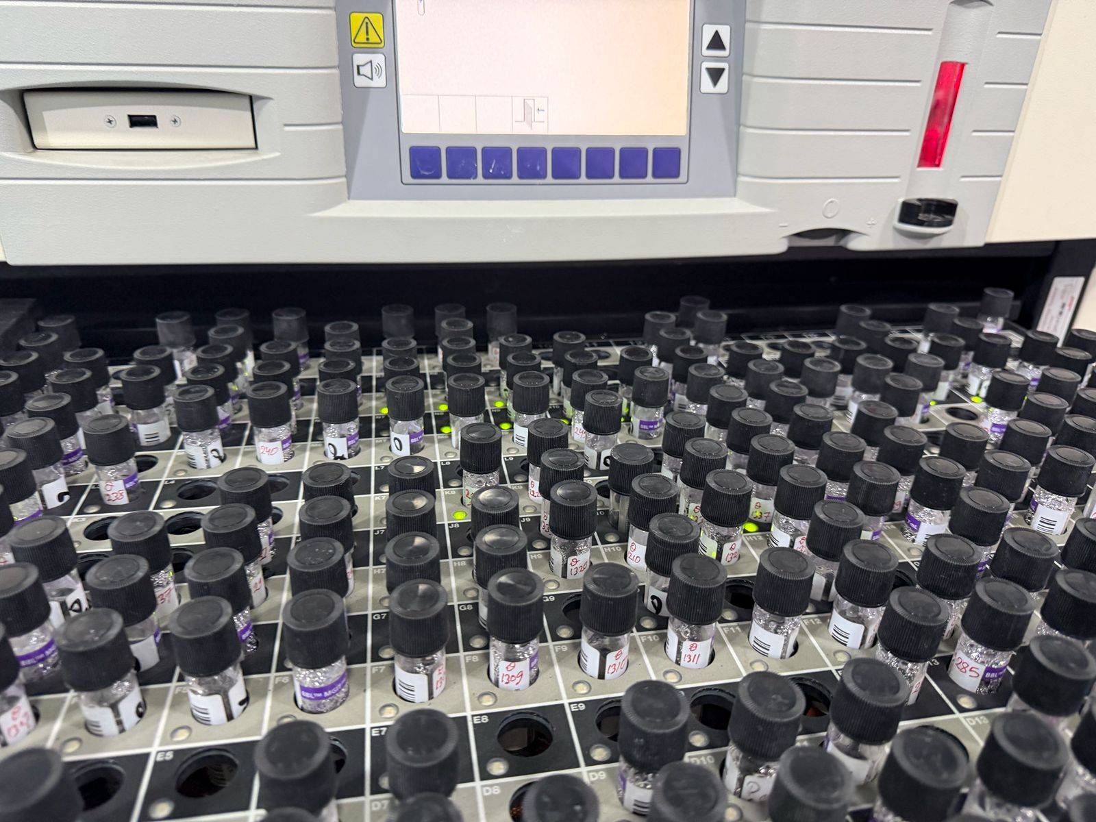 BD BACTEC™ MGIT™ 960- Principles, Workflows, and Clinical Applications