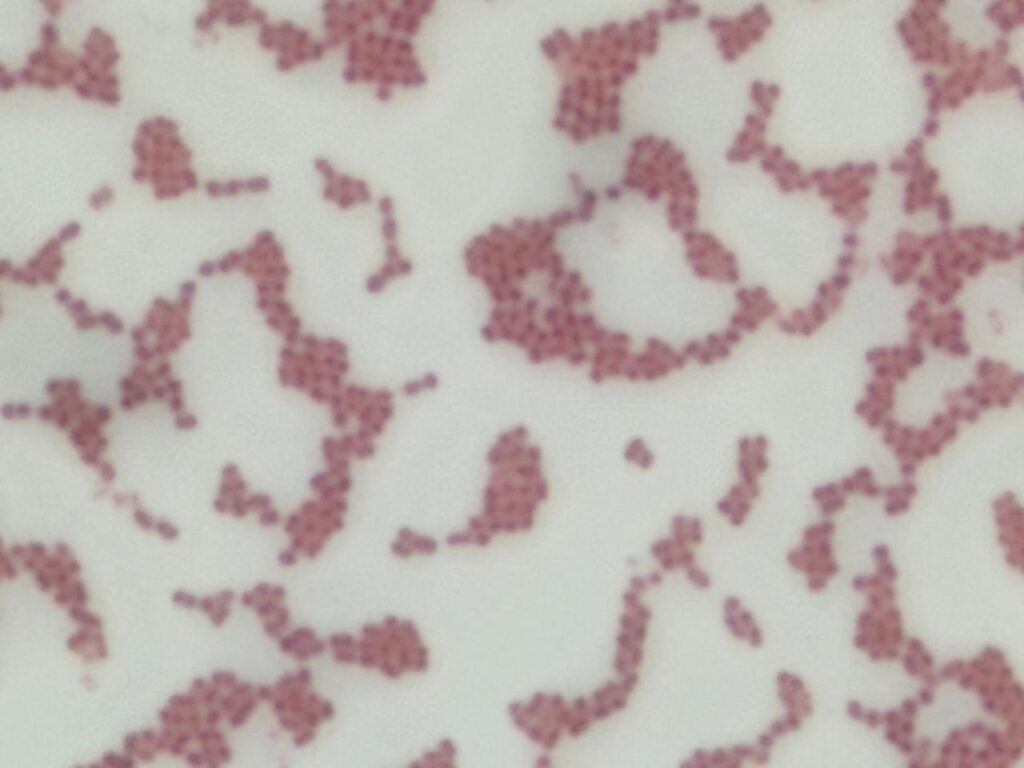 Gram-negative coccobacilli (often in pairs) of Acinetobacter baumannii complex