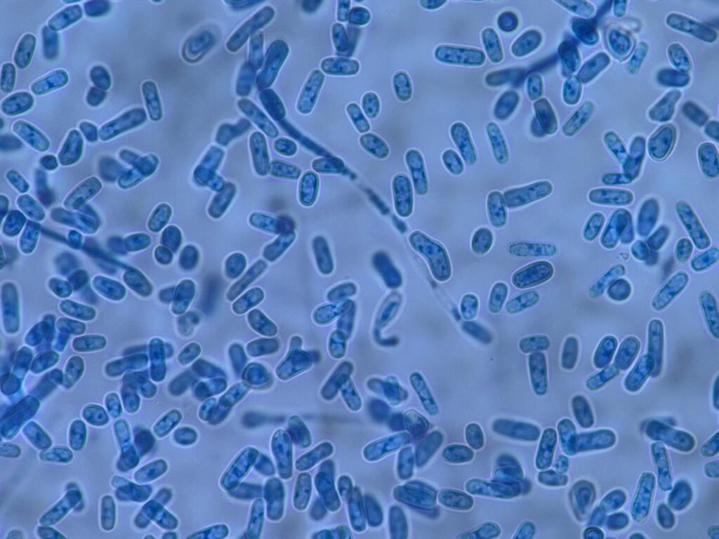 Photomicrograph of a Trichosporon LPCB mount, highlighting septate hyphae fragmenting into arthroconidia alongside rounded budding blastoconidia