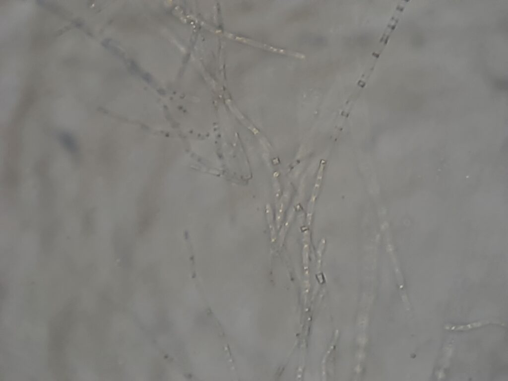 Saprochaete capitata in Dalmau plate technique microscopic footage