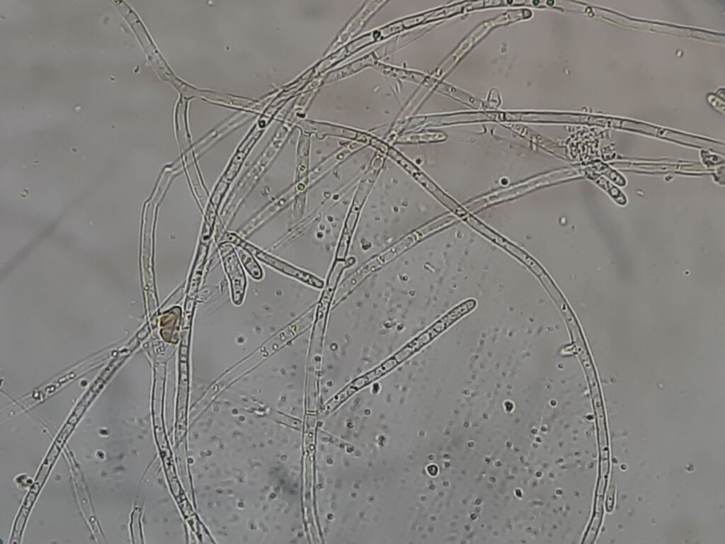 Saprochaete capitata in Germ tube test microscopy