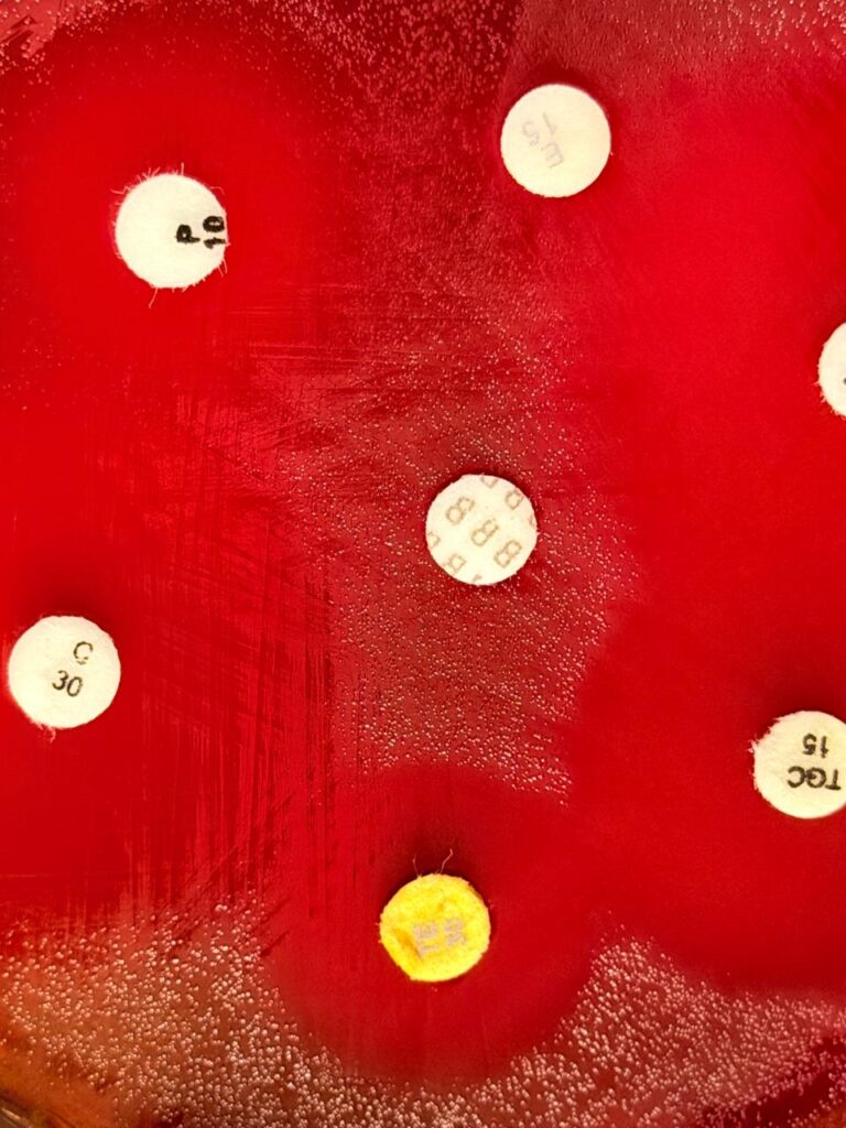 Antibiogram of Streptococcus mitis