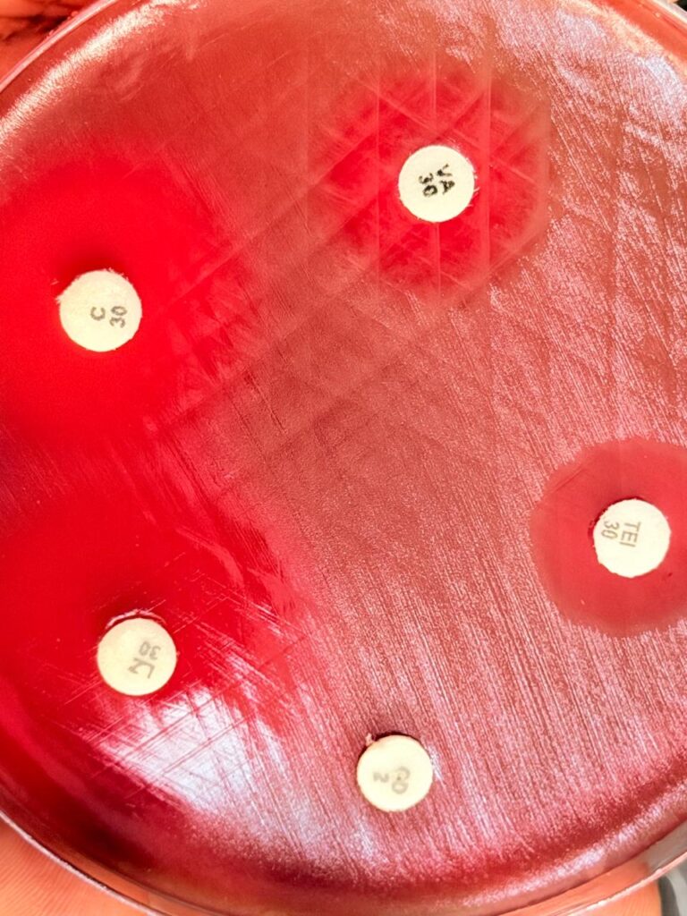Antibiotics susceptibility testing result of Streptococcus mitis
