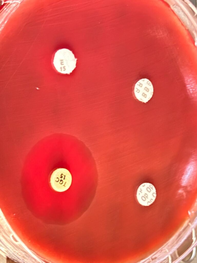 Antimicrobial susceptibility testing (AST) result of Streptococcus mitis