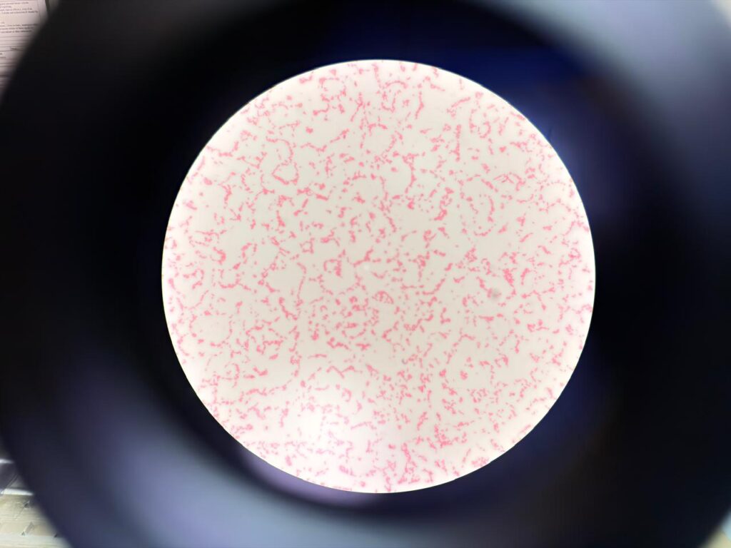 Gram-negative rods(GNRs) of Serratia marcescens at a magnification of 1000X