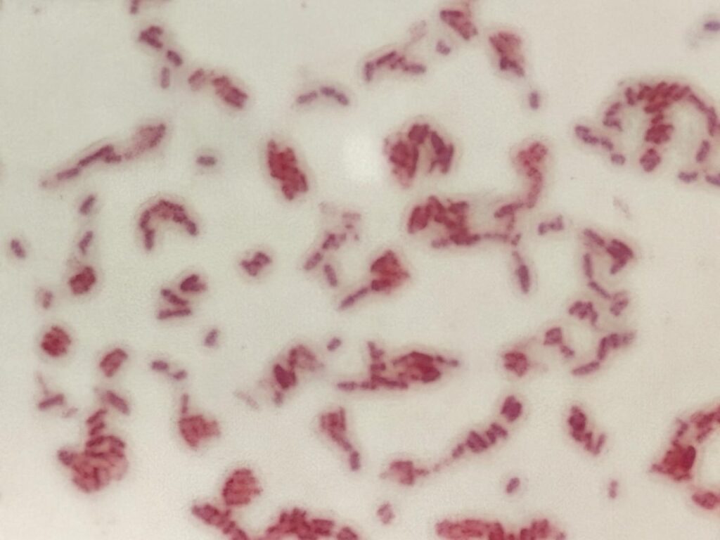 Gram-negative rods(GNRs) of Serratia marcescens at a magnification of 1000x with 8x optical zoom