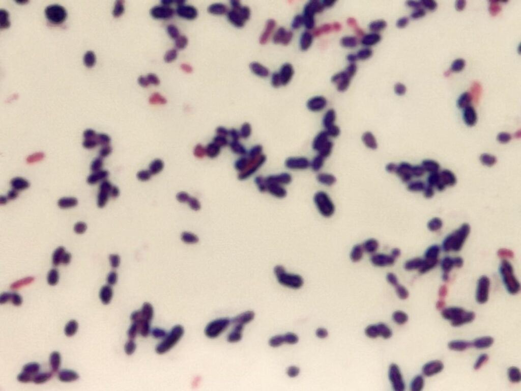 Gram positive cocci of Streptococcus mitis