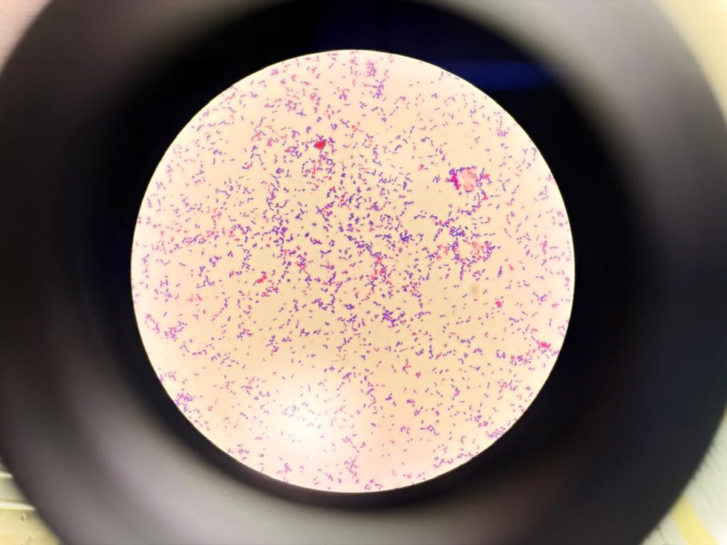 Oval or spherical cells Gram -positive cocci (GPC) in chains or pairs of Streptococcus mitis and few are resembling to Gram-negative due to older culture