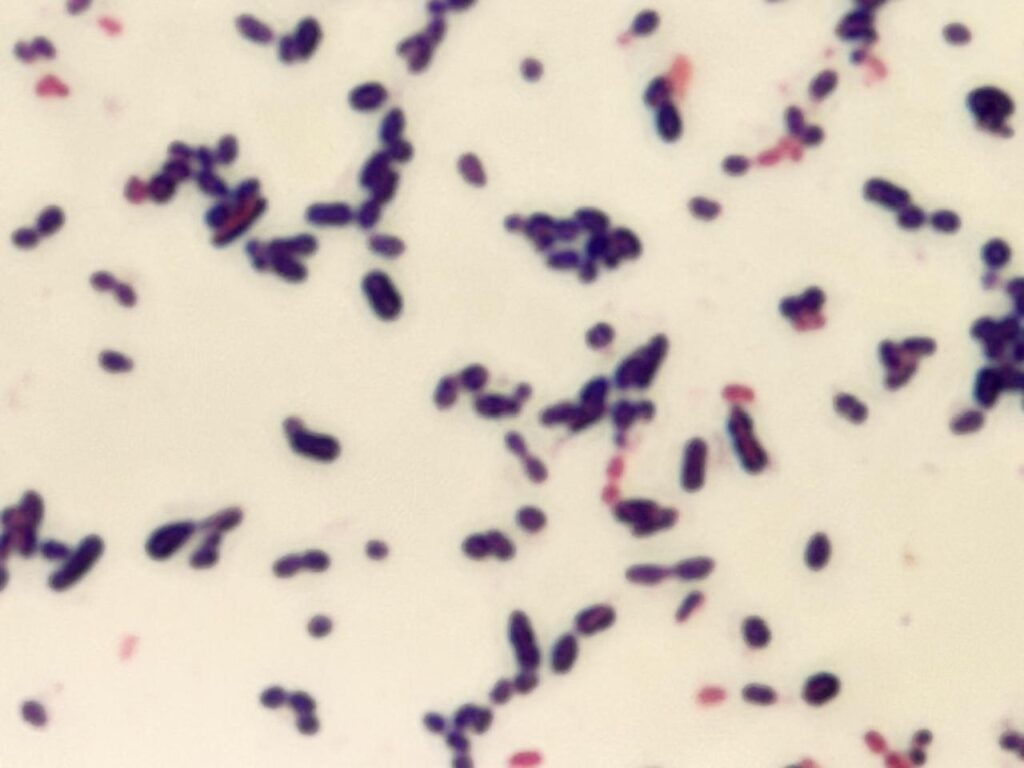 Oval or spherical cells Gram -positive cocci (GPC) in chains or pairs of Streptococcus mitis at amgnification of 1000x with 8x optical zoom