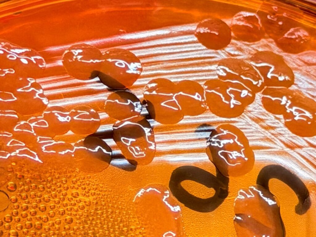 Serratia marcescens colony morphology on MacConkey medium