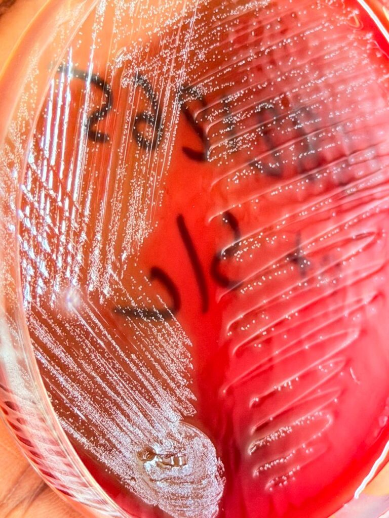 Streptococcus mitis colony morphology on blood agar