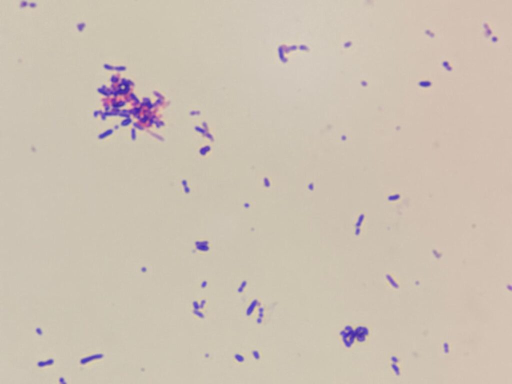 A mix of distinct shapes, varying from round or oval cocci to slightly elongated, short bacillary (rod-like) forms of Rothia