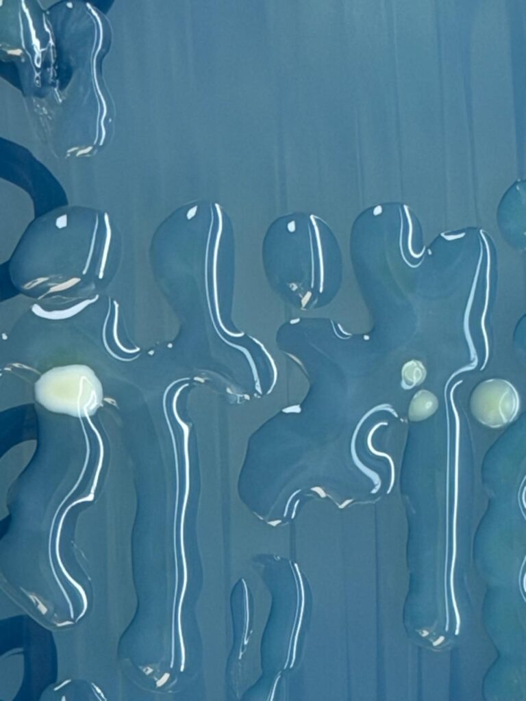 Acinetobacter lwoffii on CLED medium