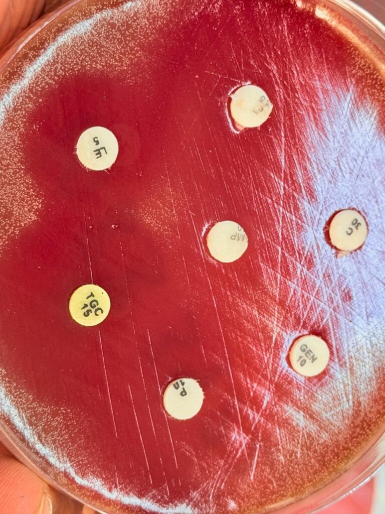 Antibiogram pattern of Rothia