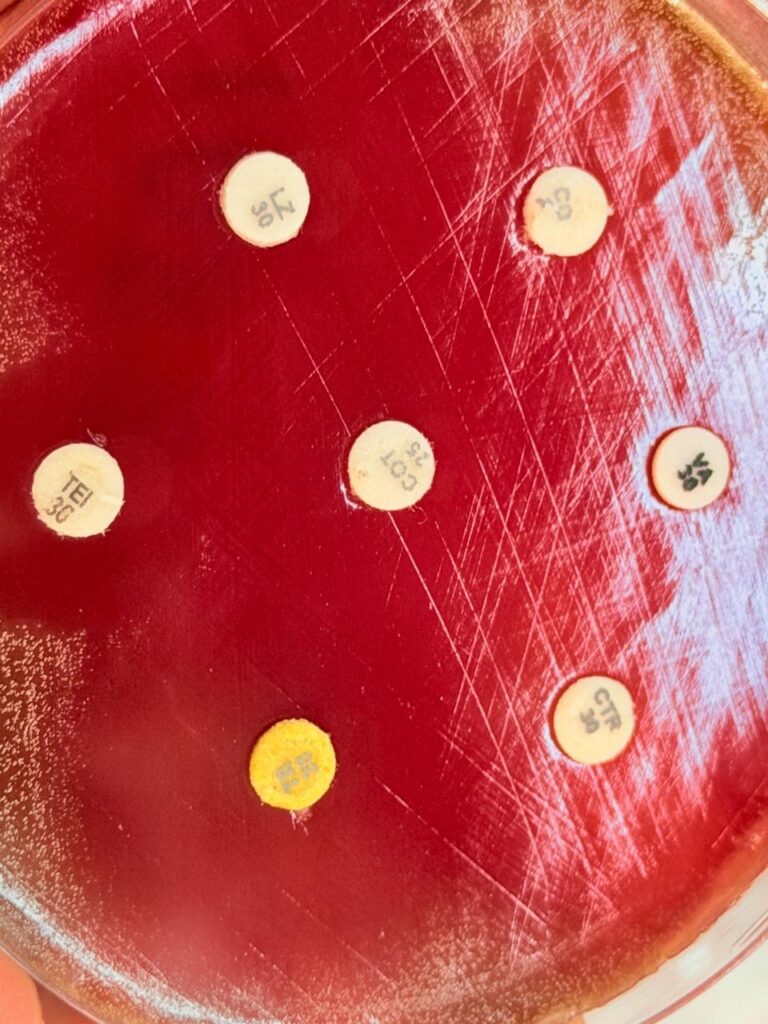 Antimicrobial susceptbility testing (AST) of Rothia species on blood agar