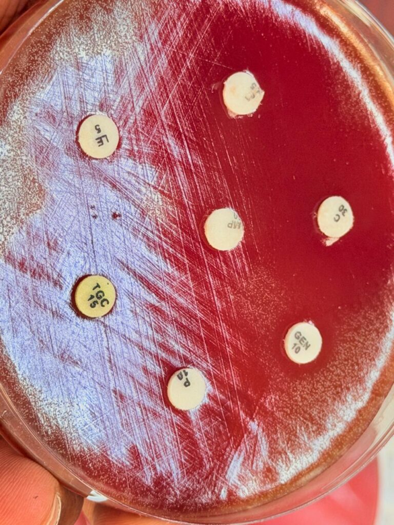 Antimicrobial susceptbility testing of Rothia