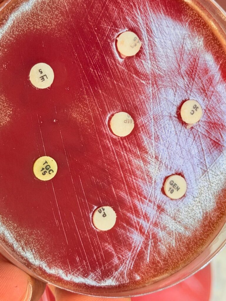 Antimicrobial susceptbility testing(AST) of Rothia species