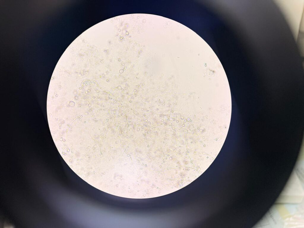 Fungal element in KOH mount