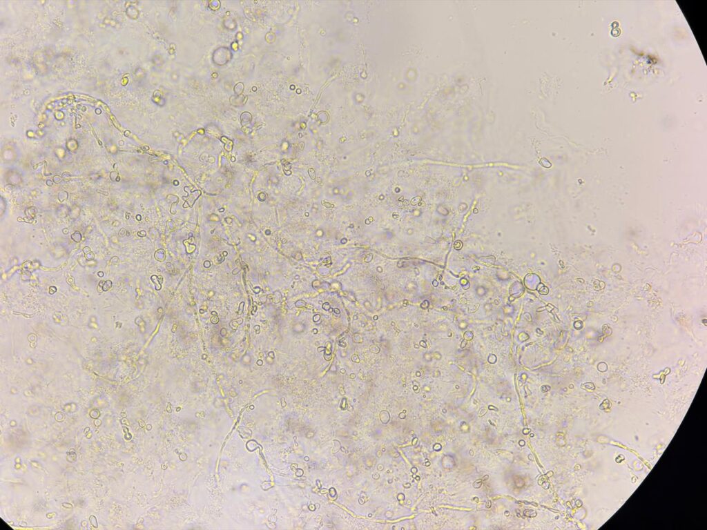 Fungal element in KOH mount of nail clipping at a magnification of 1000x with 2x optical zoom