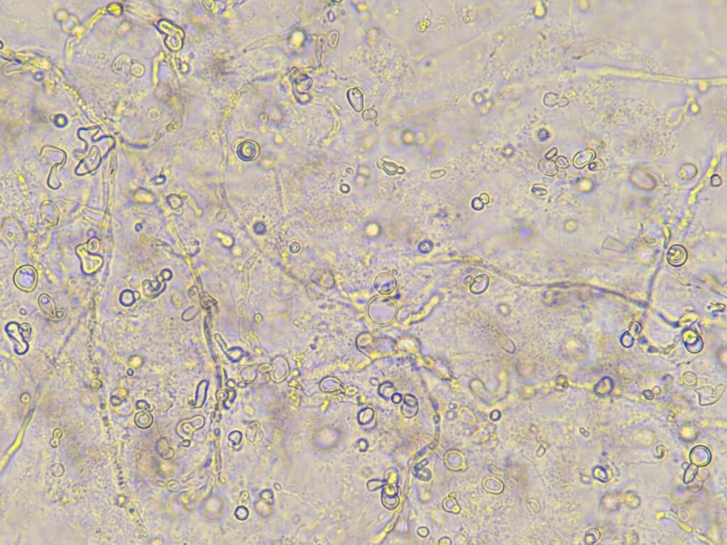 Fungal element in KOH mount of nail clipping at a magnification of 1000x with 4x optical zoom