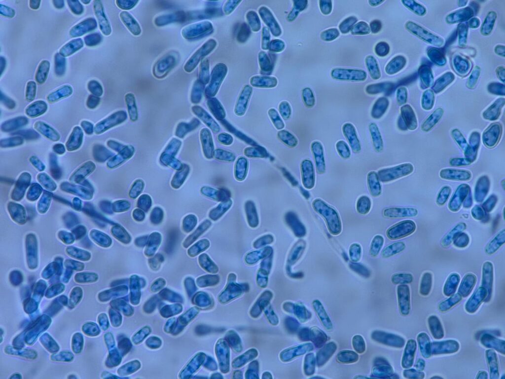 Geotrichum klebahnii in LPCB tease mount of culture showing hyphae that fragment by holoarthric division into chains of smooth, single-celled, rectangular or cylindrical arthroconidia