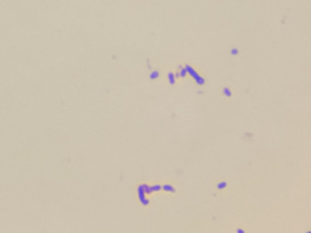 Gram-positive (purple or blue) cocci and bacilli of Rothia species in Gram staining of culture