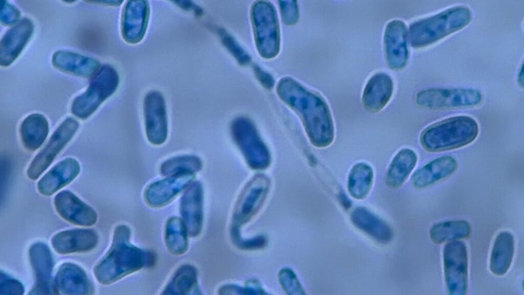 Lacking blastoconidia (budding yeast cells), distinguishing Geotrichum klebahnii from Trichosporon