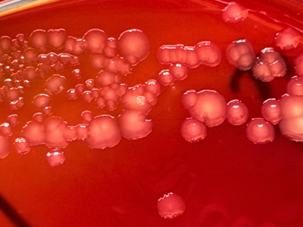 Pseudomonas putida colony morphology on blood agar after 48 hours of incubation