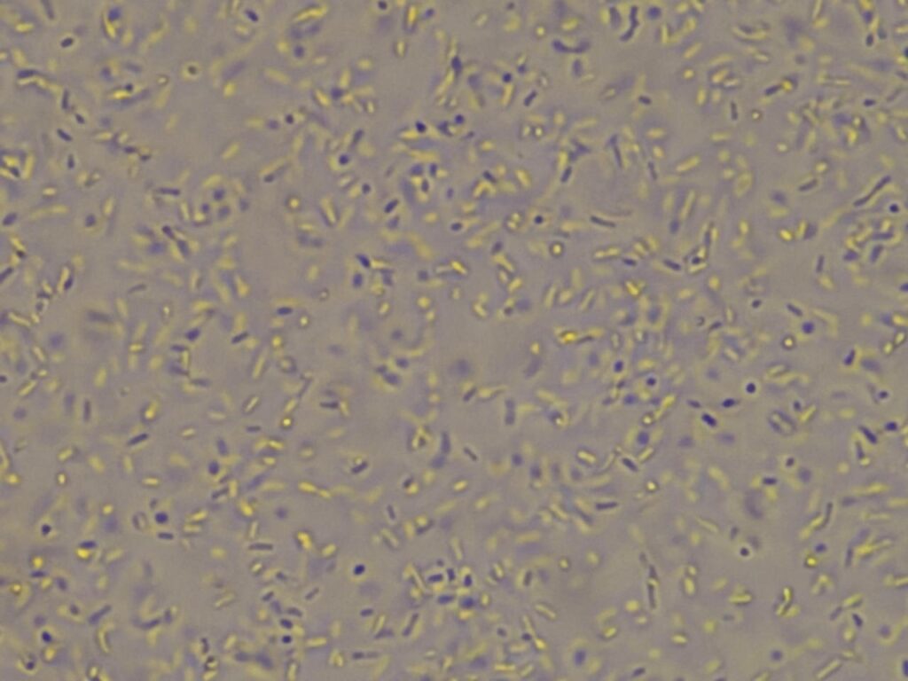 Pseudomonas putida in wet mount of culture