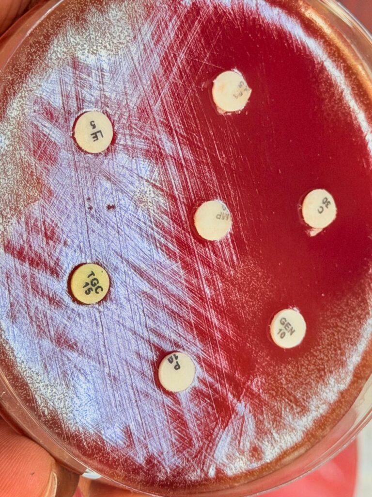Rothia antibiogram