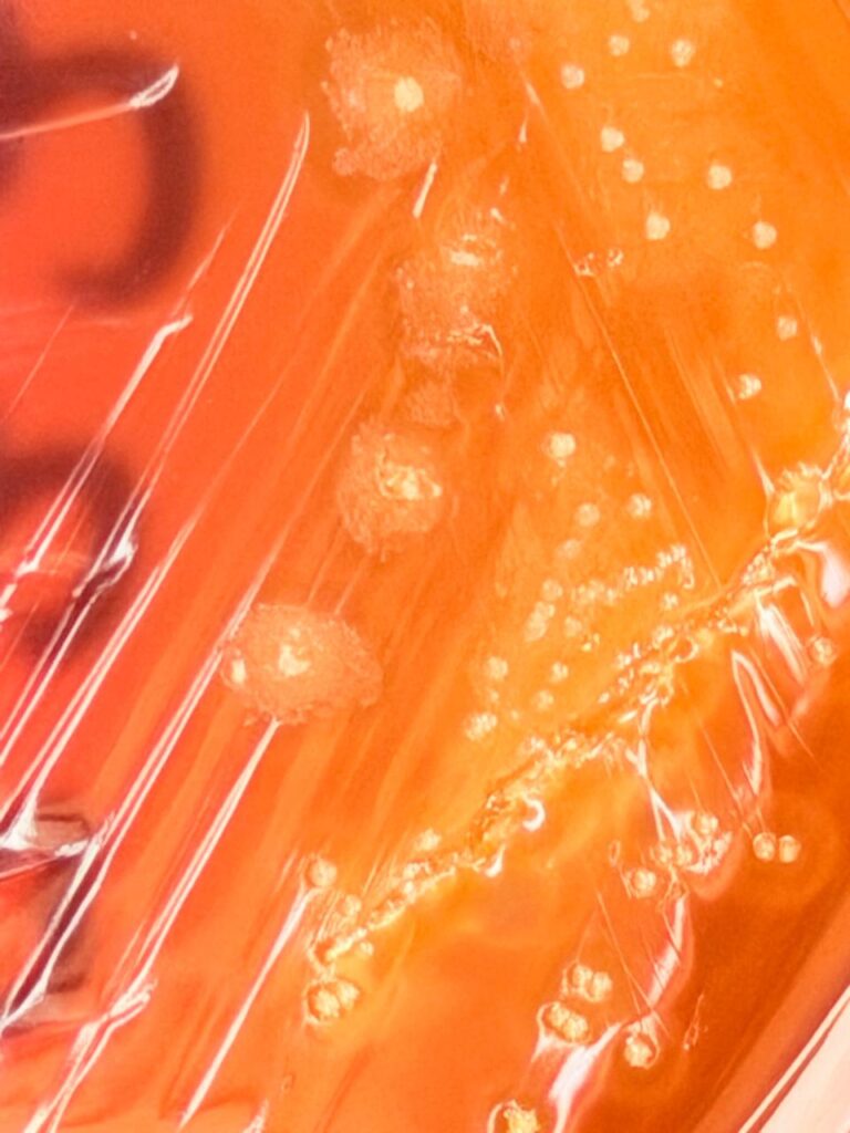 Rothia colony morphology on blood agar of blood culture