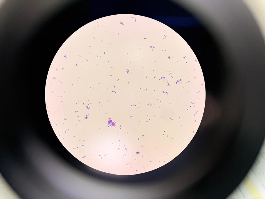 Rothia in Gram staining of culture at a magnification of 1000x -