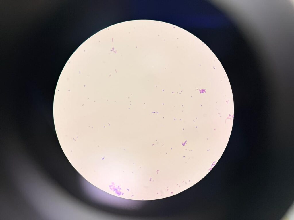 Rothia in Gram staining of culture at a magnification of 1000x