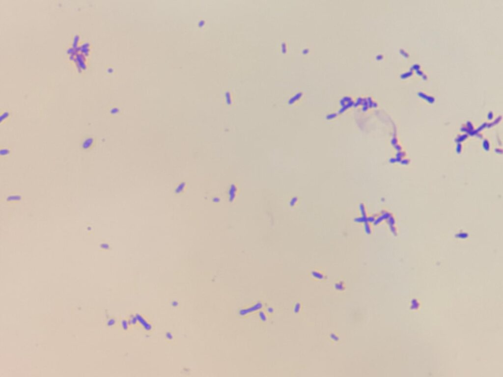 Rothia in Gram staining of culture at a magnification of 1000x with 4x optical zoom showing Gram-positive (purple or blue) bacteria