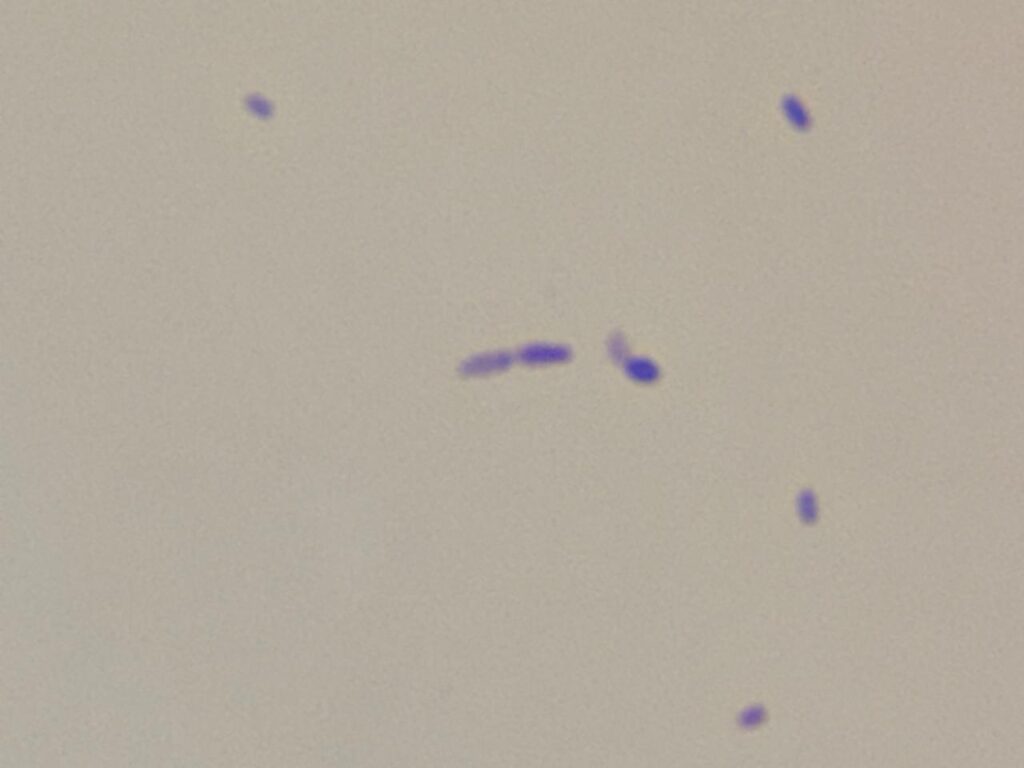 Rothia in Gram staining of culture at a magnification of 1000x with 8x optical zoom -