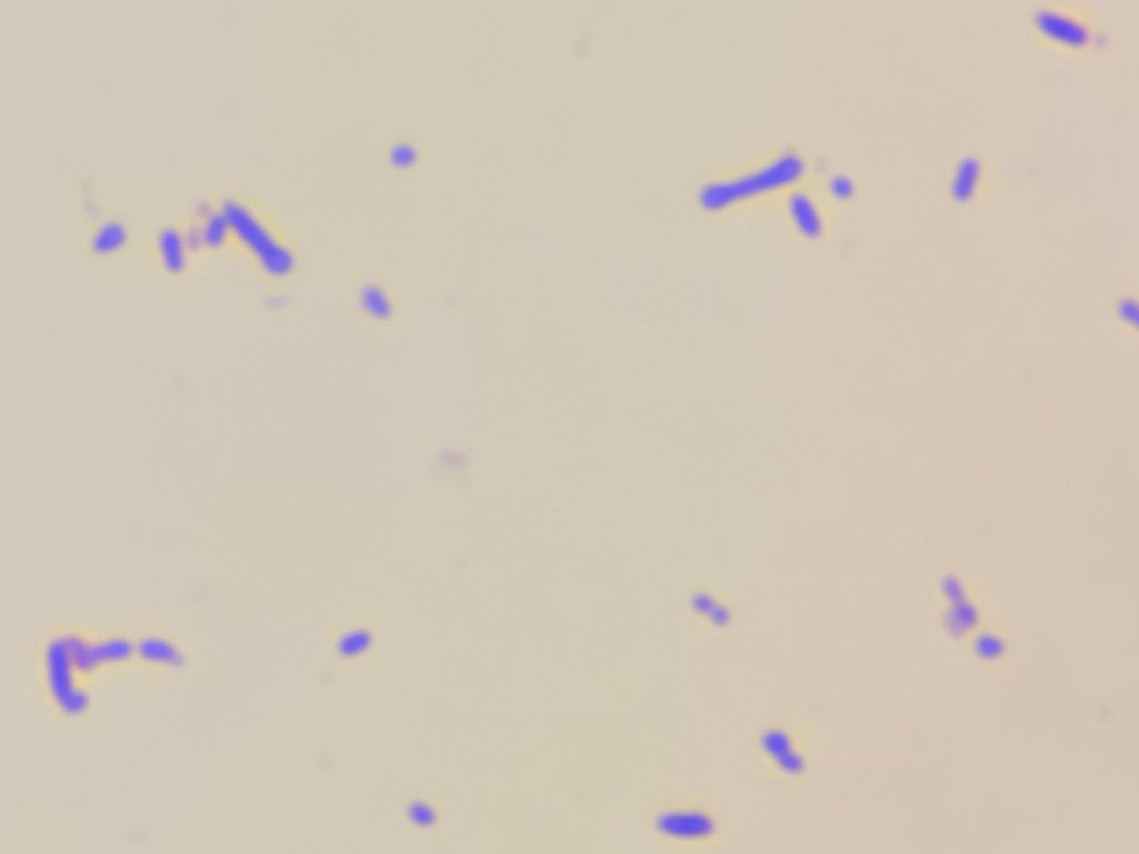 Rothia in Gram staining of culture at a magnification of 1000x with 8x optical zoom-