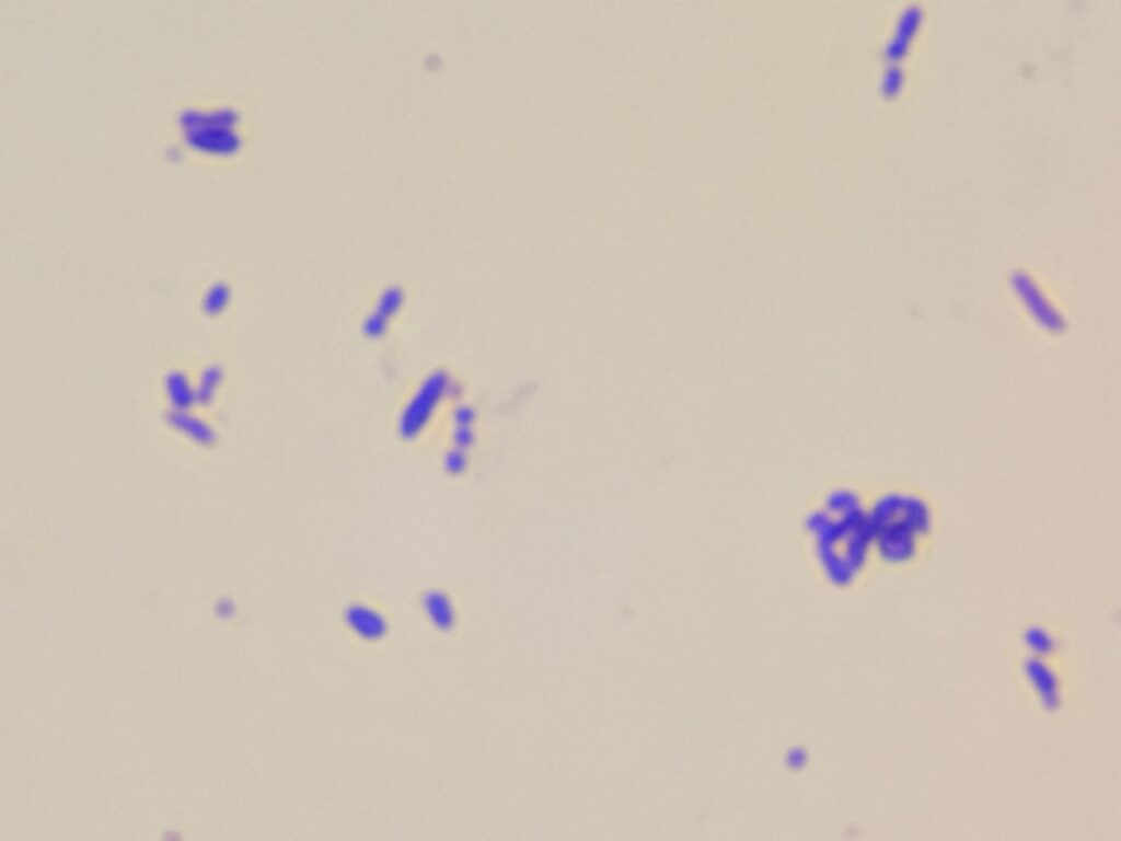 Rothia in Gram staining of culture at a magnification of 1000x with 8x optical zoom