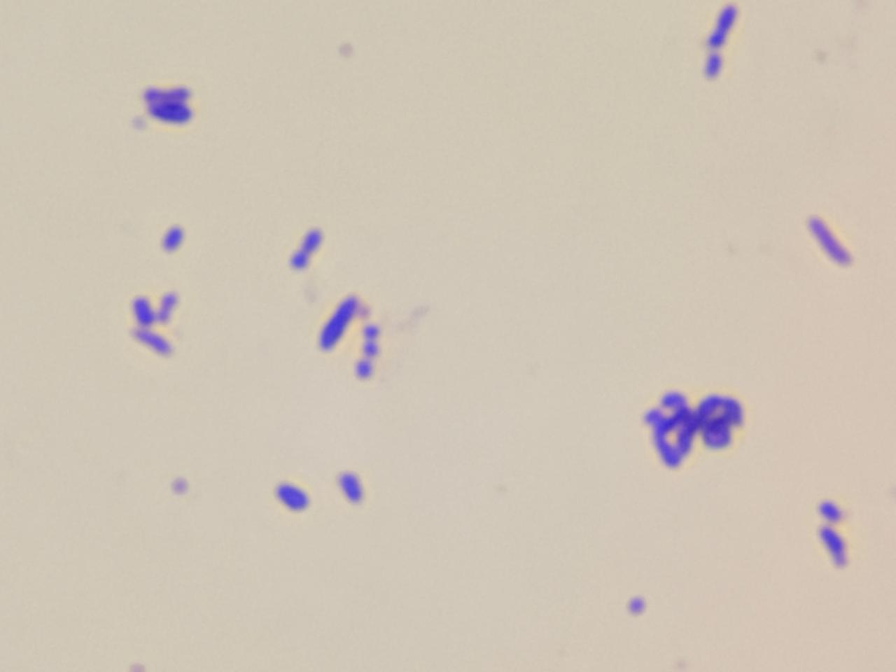 Rothia in Gram staining of culture at a magnification of 1000x with 8x optical zoom